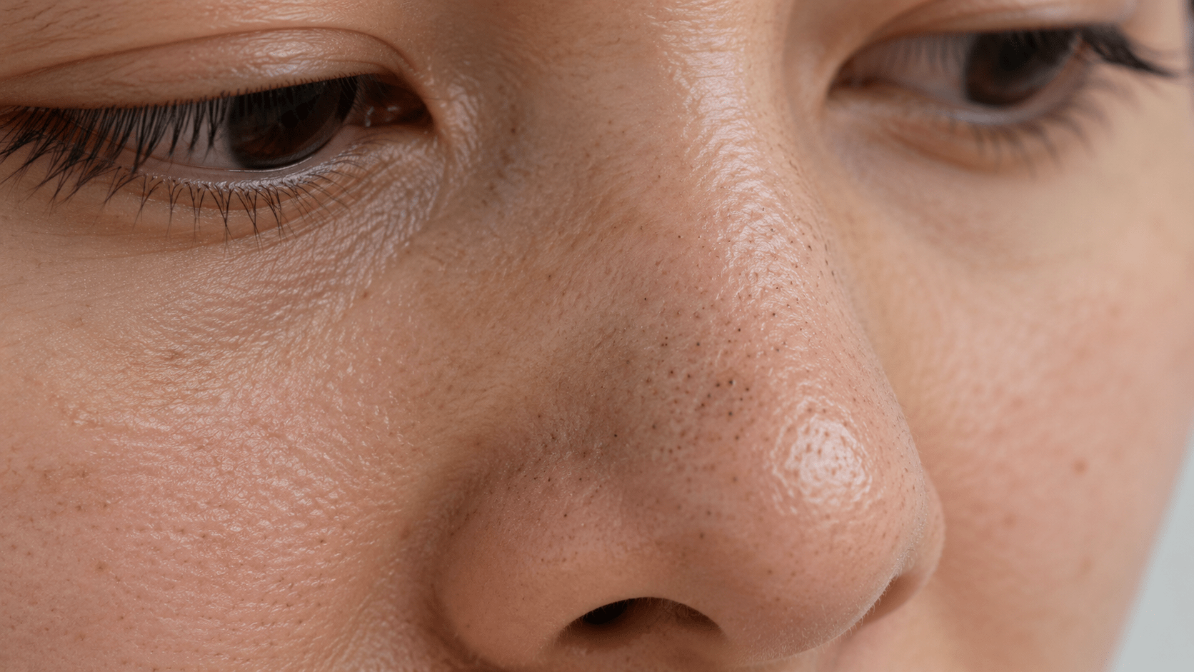 Close-up split image of a nose showing visible blackheads and clogged pores on one side and clearer, smoother skin with natural pores on the other.