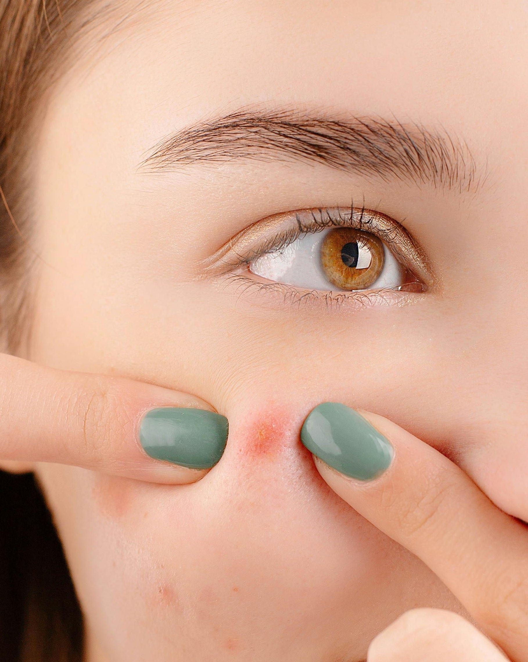 Face with skin trouble