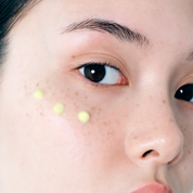 Close-up of a person's face with DR. ALTHEA Pure Retinol 0.15% Cream on the cheek, showing a natural skin texture and pore detail.